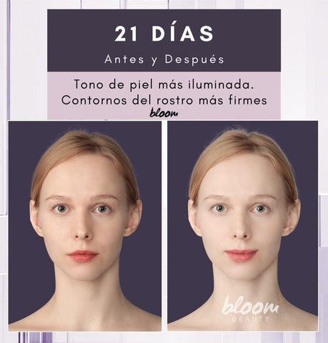 ANLAN RF Lifting Facial Portatil, Rejuvenecimiento