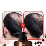 [Kundal] Shampoo Anticaida- Cherry Blossom