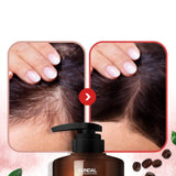 [Kundal] Shampoo Anticaida- Cherry Blossom